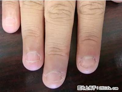 剪指甲、挖耳屎，这些日常小动作竟隐藏大危害！ - 六盘水生活资讯 - 六盘水28生活网 lps.28life.net
